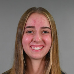 Sydney Barnes