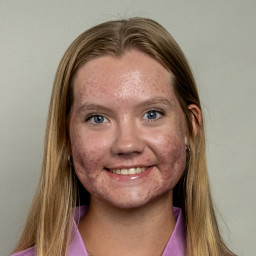 Kaila Fisher